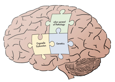 Piecing Together the Parkinson's Puzzle Maximizing Function & Improving Intervention