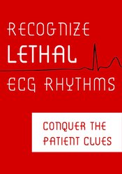 Robin Gilbert Recognize Lethal ECG Rhythms Conquer the Patient Clues