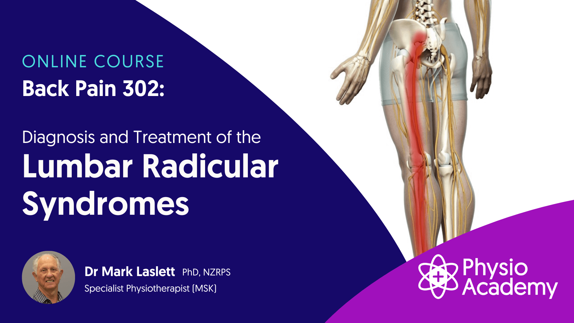 Mark Laslett - Back Pain 302 - Diagnosis and Treatment of the Lumbar Radicular Syndrome